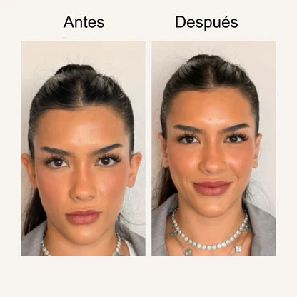 Aro corrector de orejas Auréya™