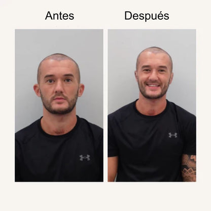 Aro corrector de orejas Auréya™