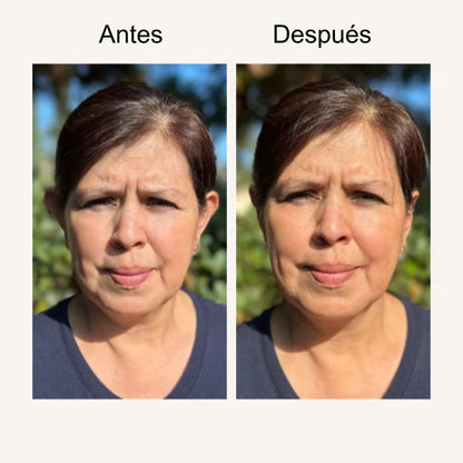 Aro corrector de orejas Auréya™